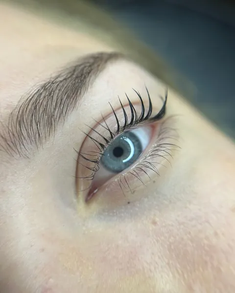 Gelifte wimpers bij een blauw oog
